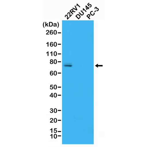22RV1 Whole Cell Lysate [RM-CL07]