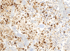 Histone H3 Mutation (Mutated K4M, K9M, K27M, K36M) + H3.3 Mutation (Mutated G34W, G34R, G34V) Antibody Panel, Clone RM191, RM192, RM193, RM363, RM263, RM240, RM307; 31-1327-MP