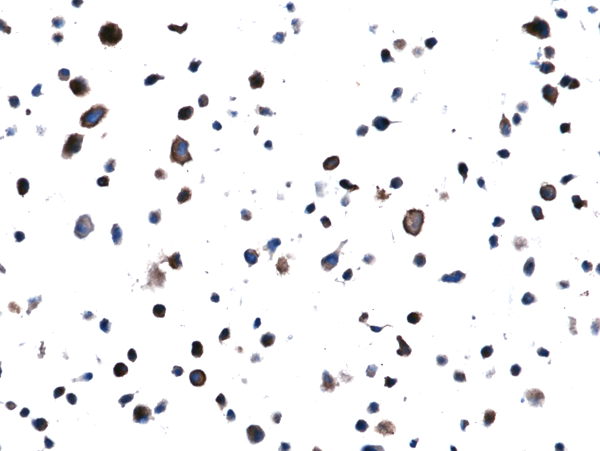 Anti-EGFR L858R Mutant Rabbit Monoclonal Antibody, Clone RM380