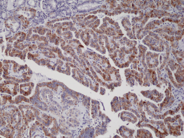 BRAF V600E Rabbit Monoclonal Antibody, Clone RM8