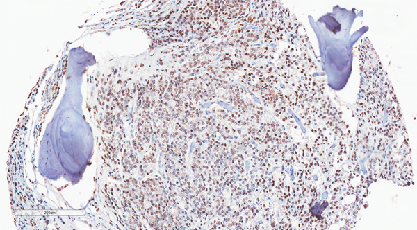 Anti-Androgen Receptor (AR-V7 specific) Rabbit Monoclonal Antibody, Clone RM7