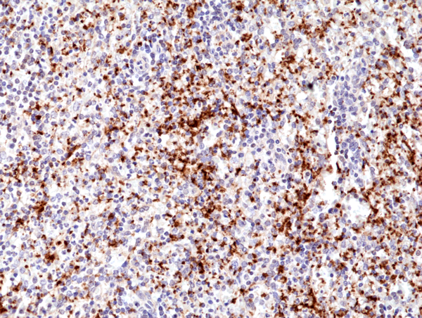 Anti-Integrin Beta3/CD61 Rabbit Monoclonal Antibody, Clone RM382