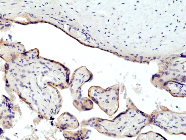 Anti-CD71 Rabbit Monoclonal Antibody, Clone RM384