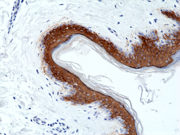 Anti-CK-10 (Cytokeratin-10) Rabbit Monoclonal Antibody, Clone RM386