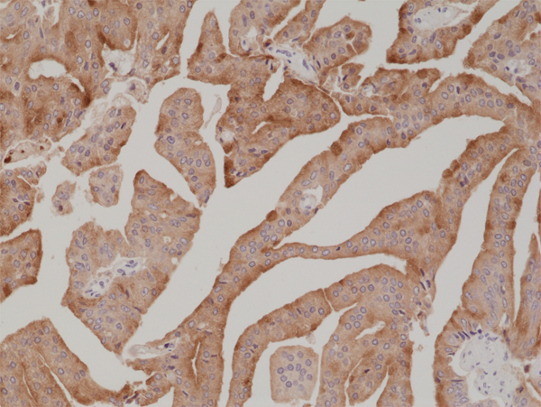 Anti-PSA (Prostate Specific Antigen) Rabbit Monoclonal Antibody, Clone RM323