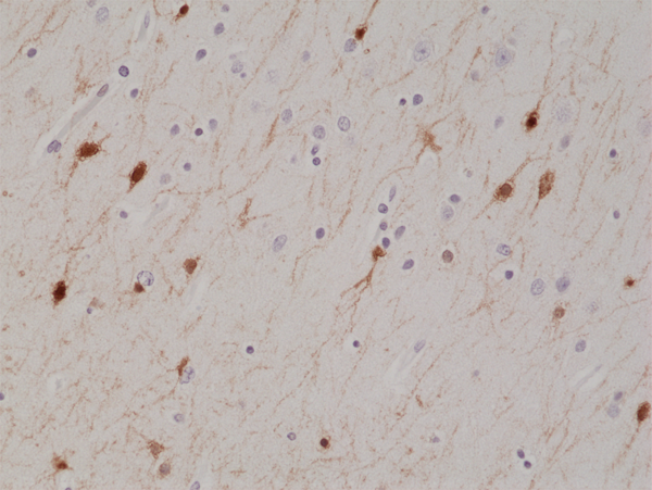Anti-Calretinin (CALB2) Rabbit Monoclonal Antibody, Clone RM324