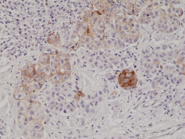 Anti-MART1 Rabbit Monoclonal Antibody, Clone RM333