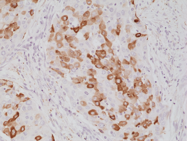 Anti-Surfactant Protein A (SP-A) Rabbit Monoclonal Antibody, Clone RM334