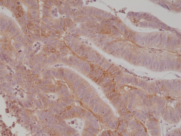 Anti-CD276 (B7-H3) Rabbit Monoclonal Antibody, Clone RM335