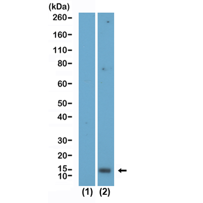 Anti-Acetyl-Histone H2A.X (Lys5) Rabbit Monoclonal Antibody, Clone RM445