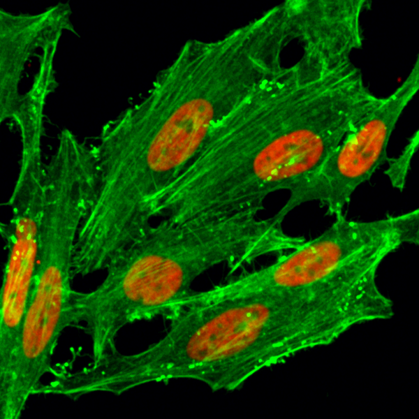 Anti-Acetyl-Histone H2.AZ (Lys7) Rabbit Monoclonal Antibody, Clone RM222