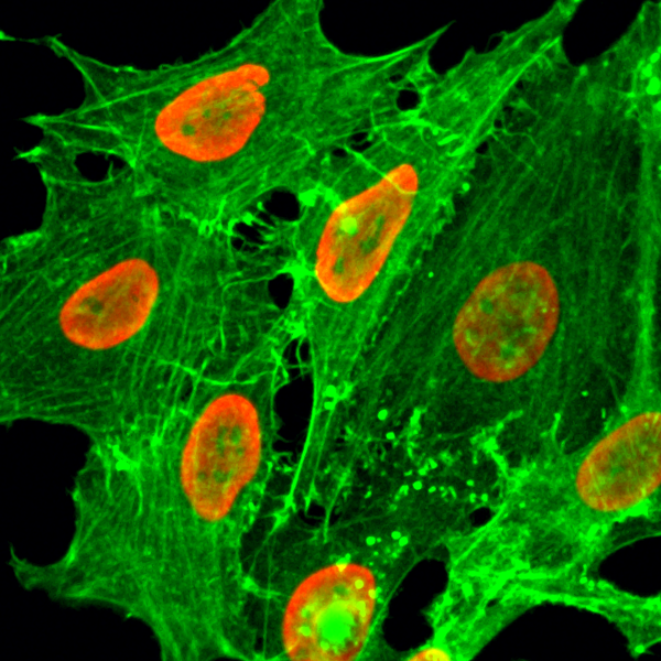 Anti-Acetyl-Histone H2B (Lys20) Rabbit Monoclonal Antibody, Clone RM235