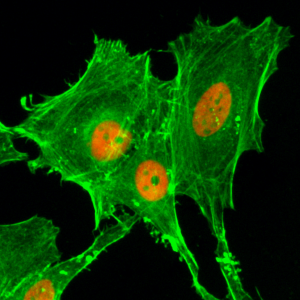 Immunocytochemical