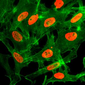 Immunocytochemistry