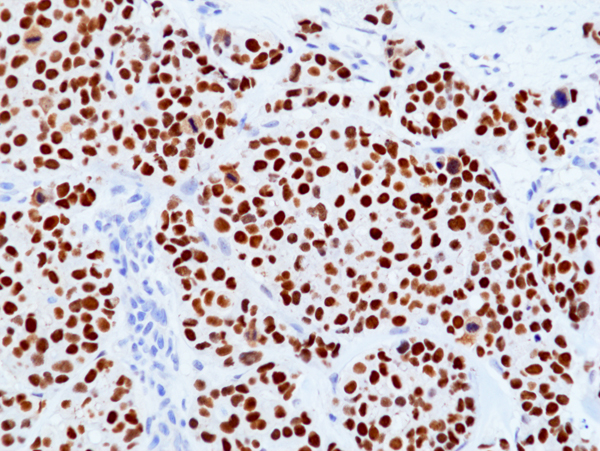 Anti-TRPS1 Rabbit Monoclonal Antibody, Clone RM518