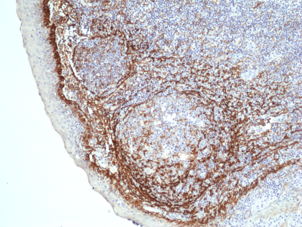 Anti-Podoplanin (Gp36) Rabbit Monoclonal Antibody, Clone RM449