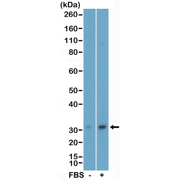 Anti-Phospho-eIF4E (Ser209) Rabbit Monoclonal Antibody, Clone RM452