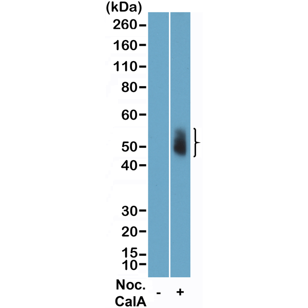Anti-Phospho-Aurora A (Thr288)/Aurora B (Thr232)/Aurora C (Thr198) Rabbit Monoclonal Antibody, Clone RM454