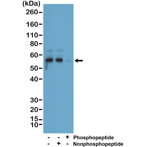 Anti-Phospho-Tau (Ser396) Rabbit Monoclonal Antibody , Clone RM461