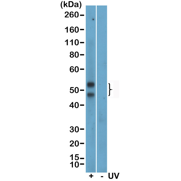 Anti-Phospho-JNK1/2/3 (Thr183/Tyr185) Rabbit Monoclonal Antibody , Clone RM464