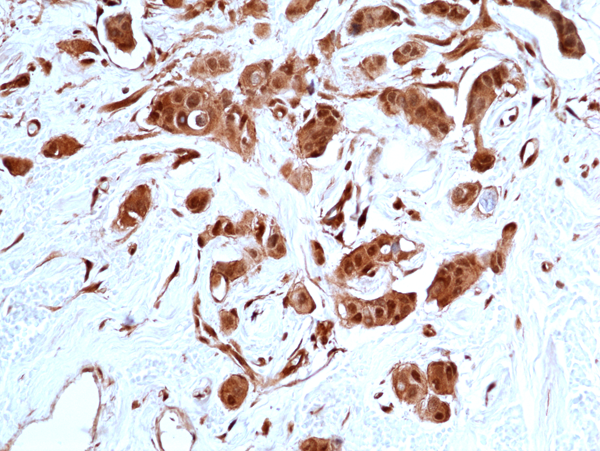 Anti-Stat3 Rabbit Monoclonal Antibody, Clone RM465