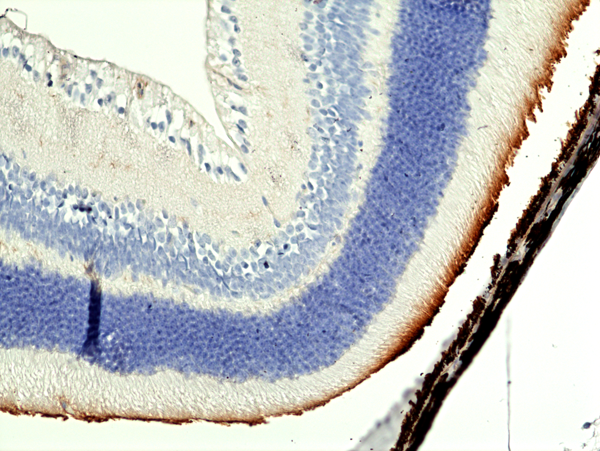 Anti-mouse MerTK Rabbit Monoclonal Antibody, Clone RM469