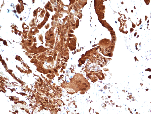 Anti-Erk1 (p44-MAPK) Rabbit Monoclonal Antibody, Clone RM470
