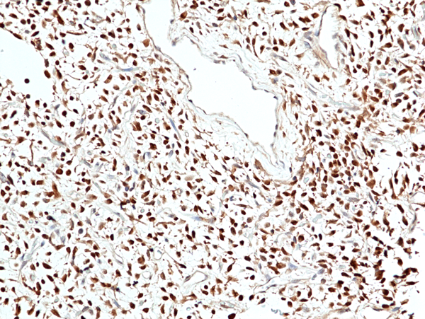 Anti-Stat6 Rabbit Monoclonal Antibody, Clone RM473