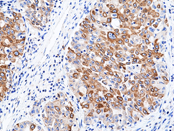 Anti-ALK Rabbit Monoclonal Antibody, Clone RM512