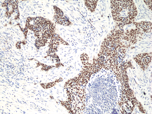 Anti-p40 (deltaNp63) Rabbit Monoclonal Antibody, Clone RM392