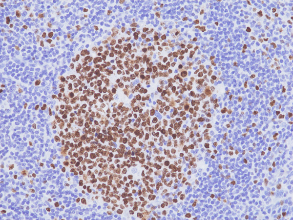 Anti-Ki-67 Rabbit Monoclonal Antibody, Clone RM521