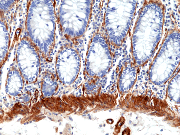 Anti-CALD1 (Caldesmon) Rabbit Monoclonal Antibody, Clone RM396