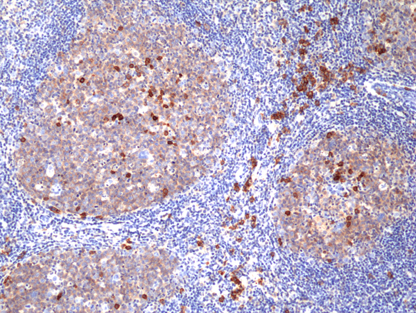 Anti-CD38 Rabbit Monoclonal Antibody, Clone RM388