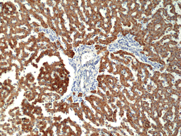Anti-CPS1 Rabbit Monoclonal Antibody, Clone RM395