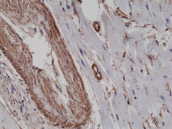 Anti-alpha smooth muscle Actin (ACTA2) Rabbit Monoclonal Antibody, Clone RM253