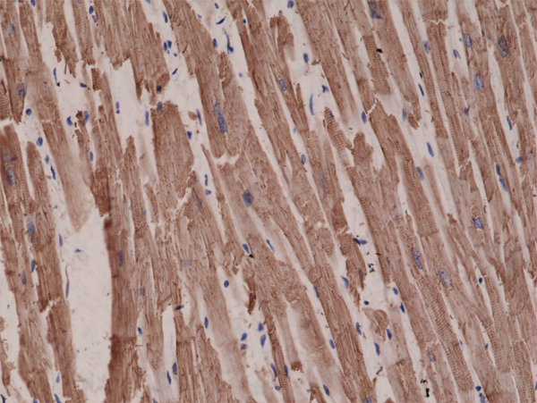 Anti-Alpha Cardiac Actin (ACTC1) Rabbit Monoclonal Antibody, Clone RM257