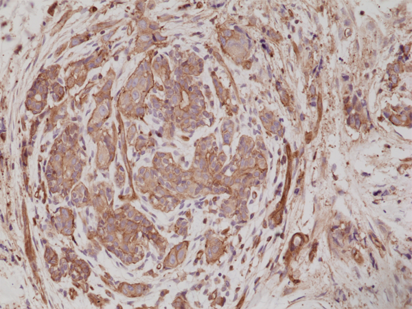 Anti-alpha-Actinin-4 Rabbit Monoclonal Antibody Rabbit Monoclonal Antibody, Clone RM287