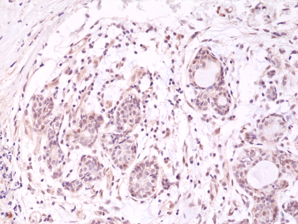 Anti-AKT (PH domain) Rabbit Monoclonal Antibody, Clone RM316