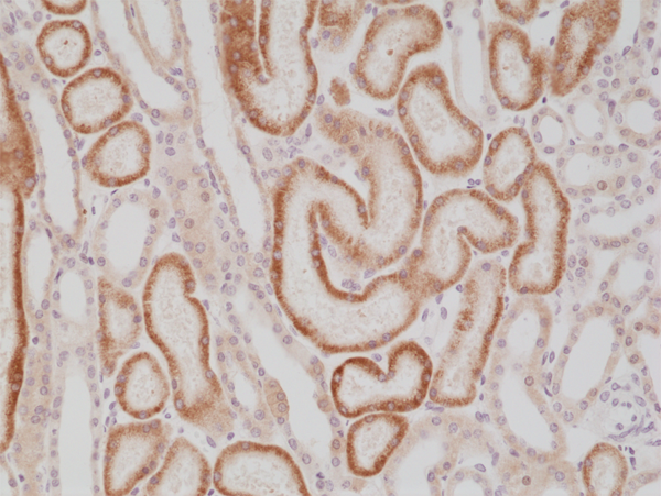 Anti-p504s/AMACR Rabbit Monoclonal Antibody, Clone RM349