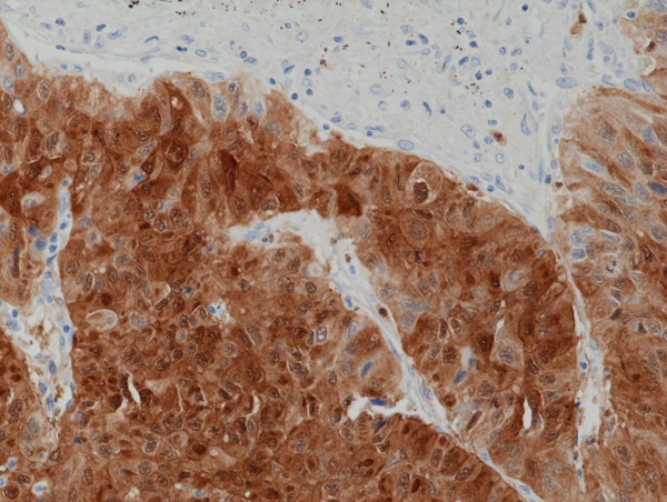 Anti-Arginase-1 (ARG1) Rabbit Monoclonal Antibody, Clone RM377