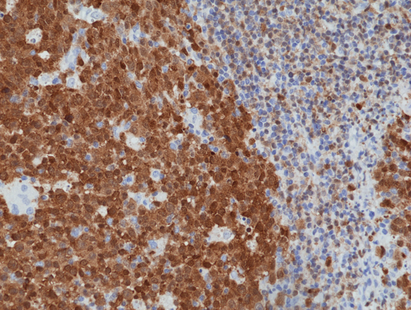 Anti-BOB-1/OBF-1 Rabbit Monoclonal Antibody, Clone RM378