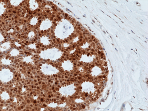 Immunohistochemical