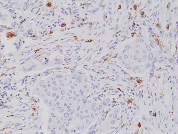 Anti-CD117/c-Kit Rabbit Monoclonal Antibody, Clone RM359