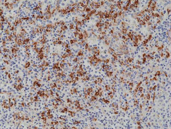Anti-CD163 Rabbit Monoclonal Antibody, Clone RM371