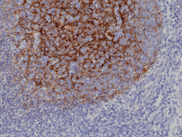 Anti-CD21 Rabbit Monoclonal Antibody, Clone RM372 (C-Terminus)