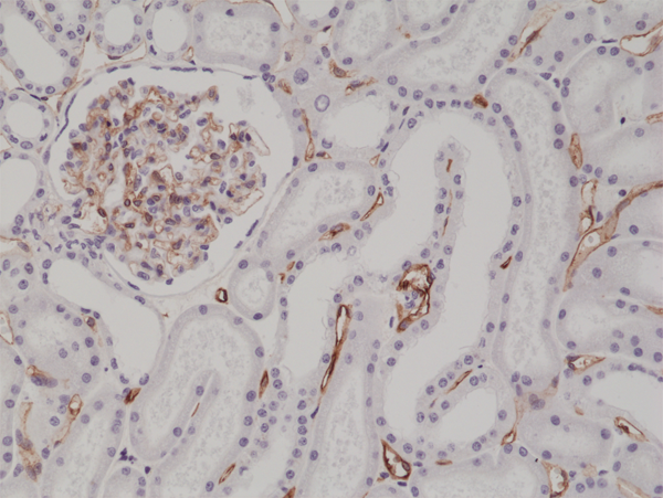 Anti-CD34 Rabbit Monoclonal Antibody Rabbit Monoclonal Antibody, Clone RM300