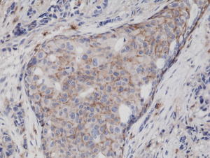 Immunohistochemical