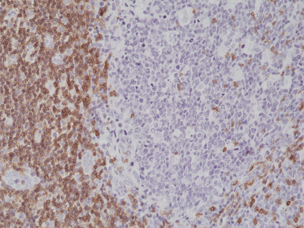 Anti-CD5 Rabbit Monoclonal Antibody, Clone RM314