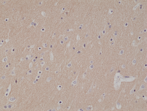 Anti-CD56 Rabbit Monoclonal Antibody, Clone RM315