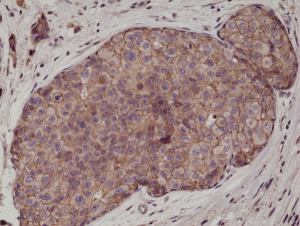 Immunohistochemical